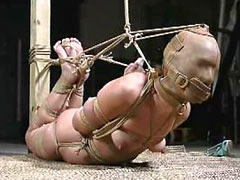 Painful saline injection